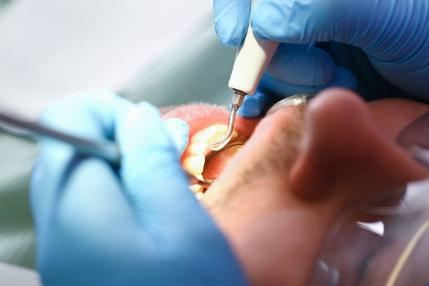 Best After-Hours Emergency Dentist in Jackson, KY